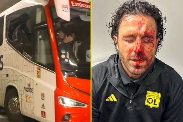 Football World surprised by Attack on Lyon Team Bus, Manager Fabio Grosso Seriously Injured